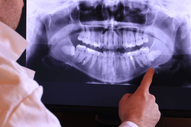 Best Emergency Dental Care for Broken or Chipped Teeth in Waskom, TX