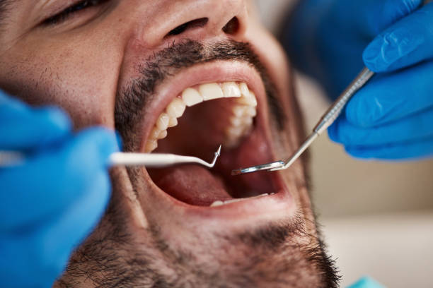 Best Emergency Dental Care for Broken or Chipped Teeth in Waskom, TX