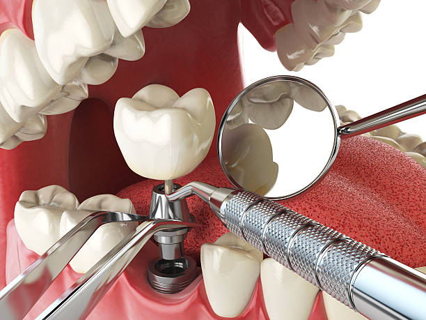 Best Emergency Gum Treatment in Waskom, TX